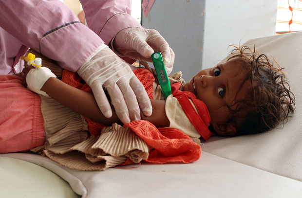المجاعات والأوبئة تنتشر في اليمن بمعدلات كبيرة (أ.ف.ب)
