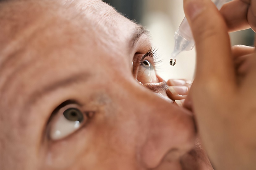 وضع القطرة من علاجات جفاف العين
