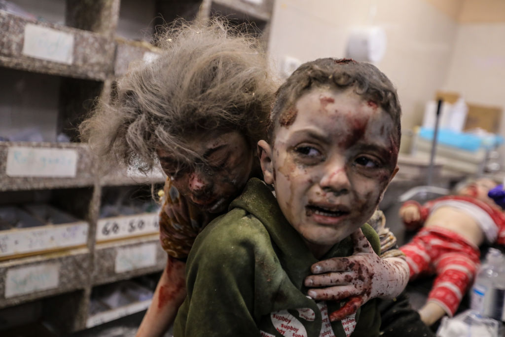 طفل مصاب في إحدى مستشفيات غزة