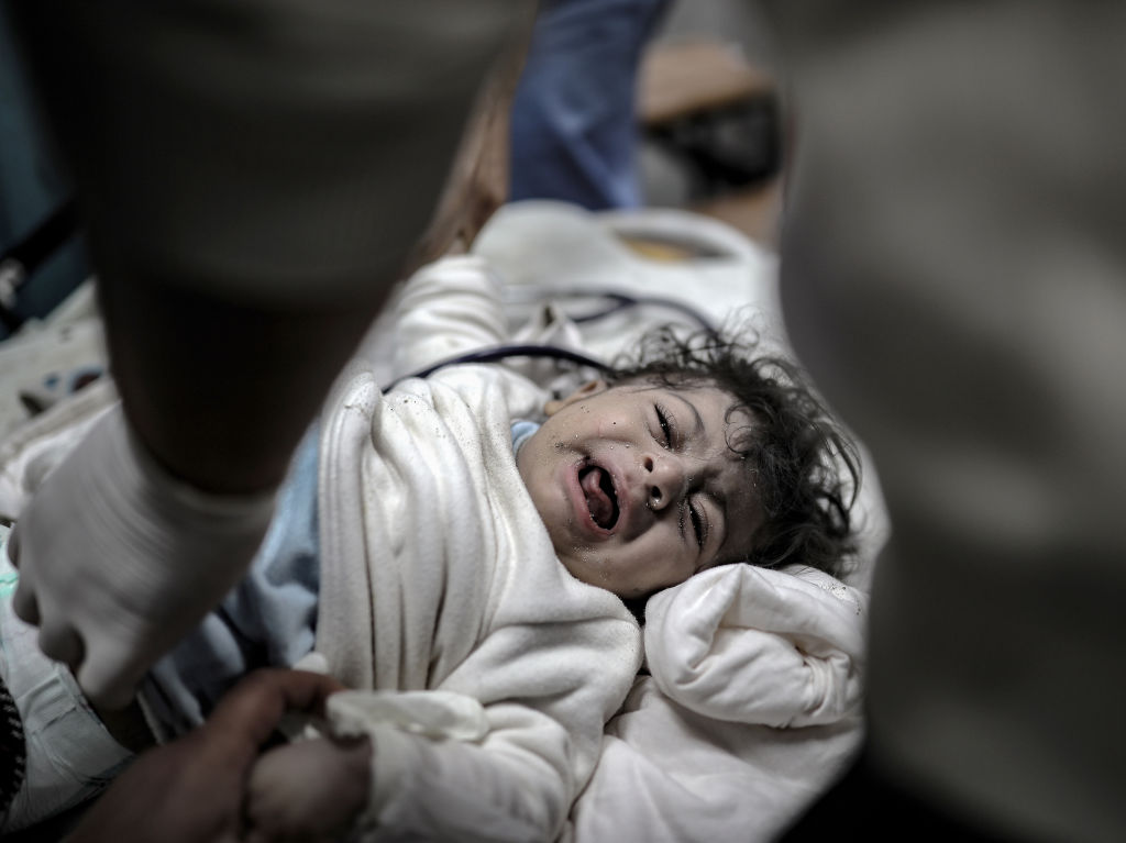 طفلة فلسطينية مصابة