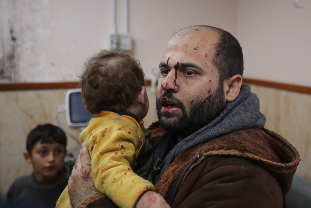 فلسطيني مصاب مع طفله بمدينة دير البلح