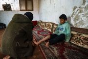 طفل سوري تضررت قدمه نتيجة انفجار قنبلة عنقودية