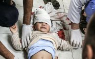 طفل جريح في غزة