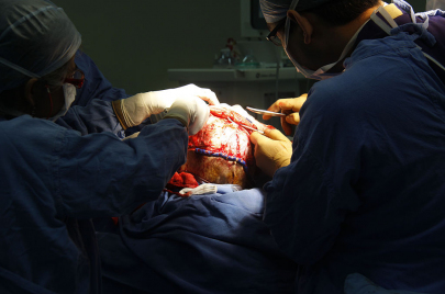 عملية جراحية لطفل
