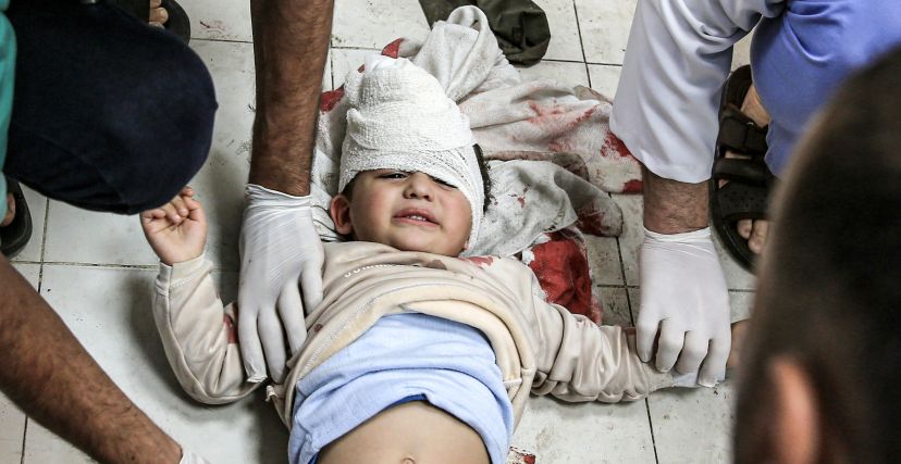 طفل جريح في غزة